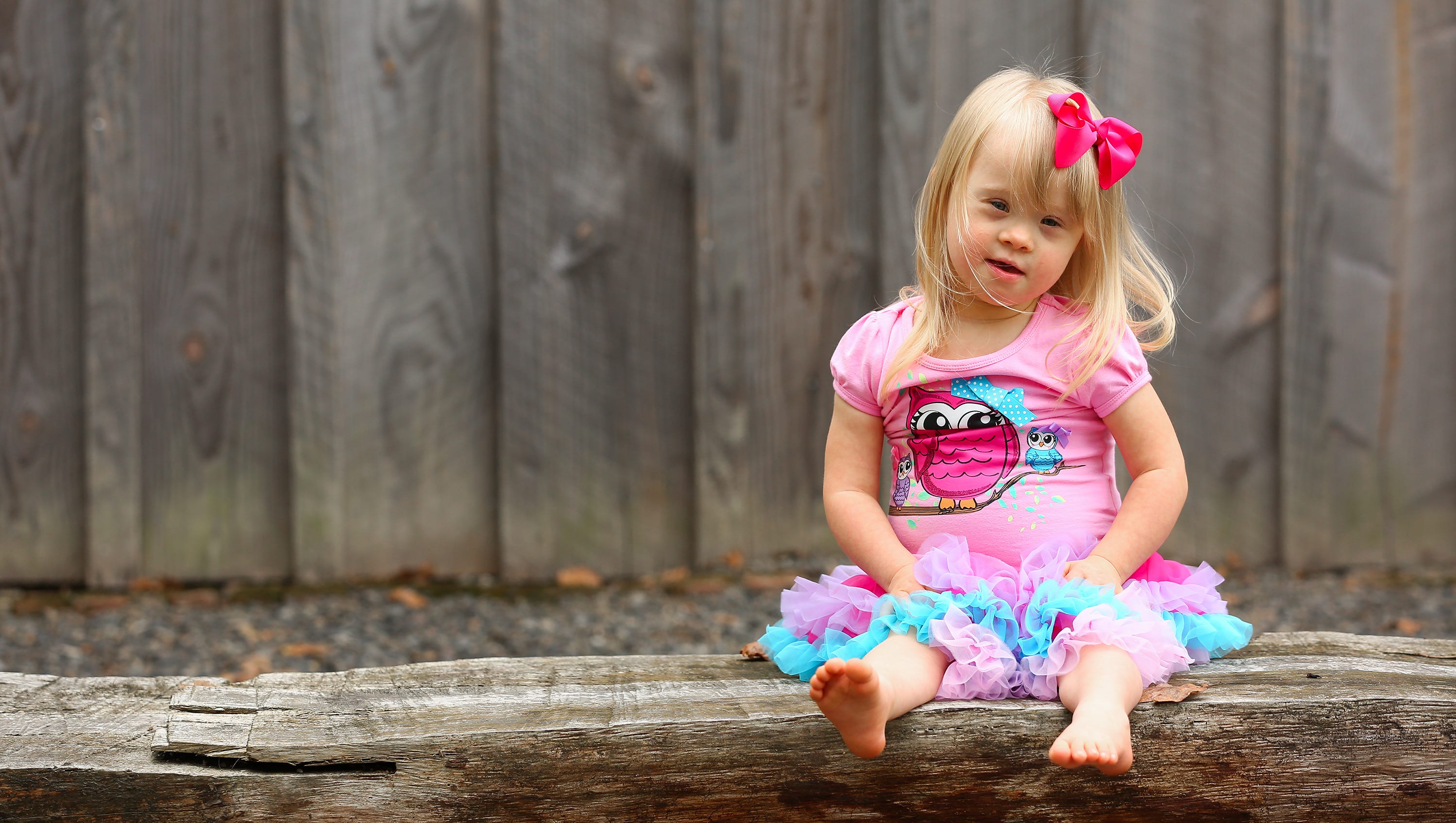 Girl with Down syndrome changing face of modeling