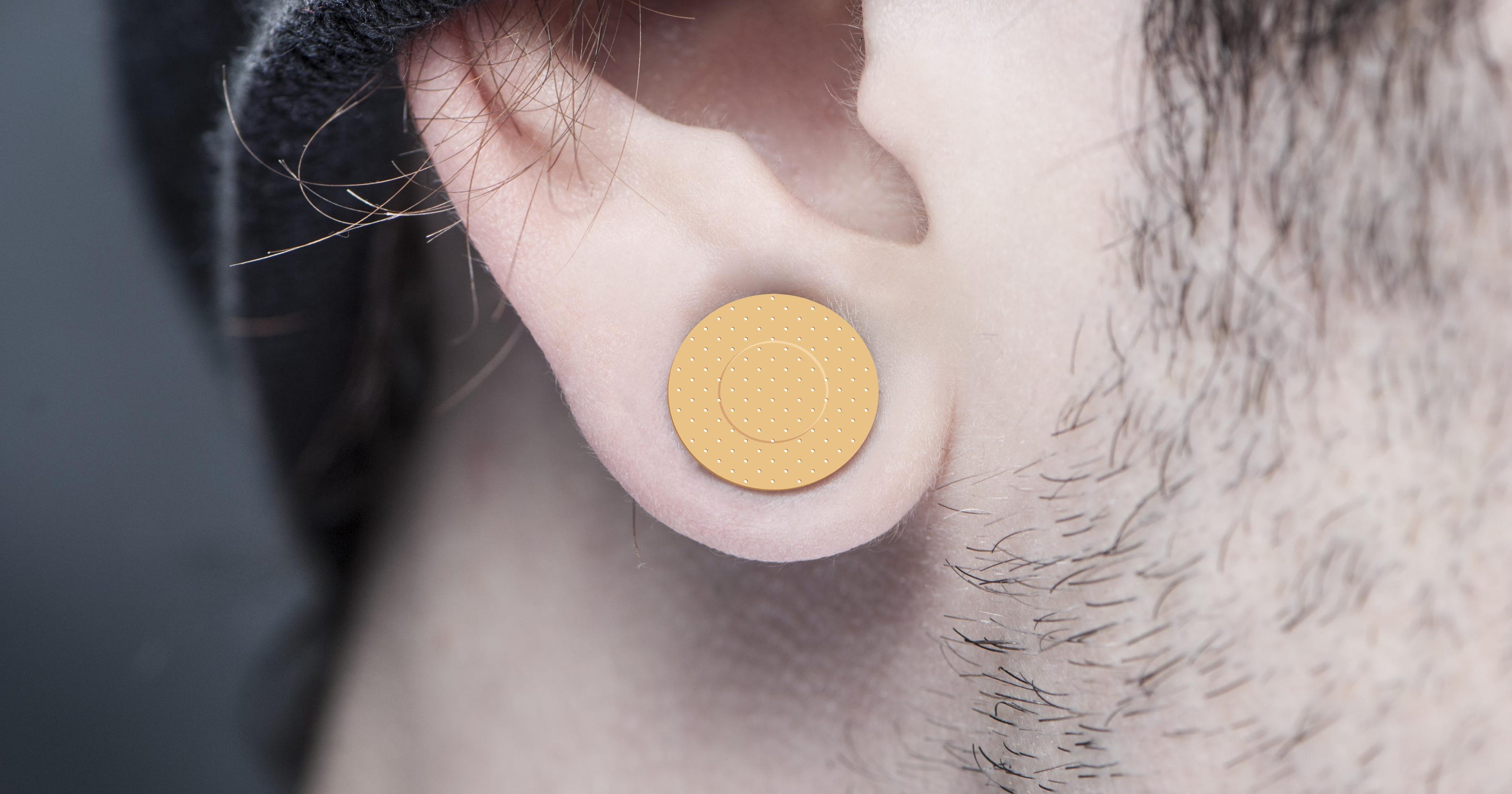 Millennials looking to fix overpiercing, remove tattoos