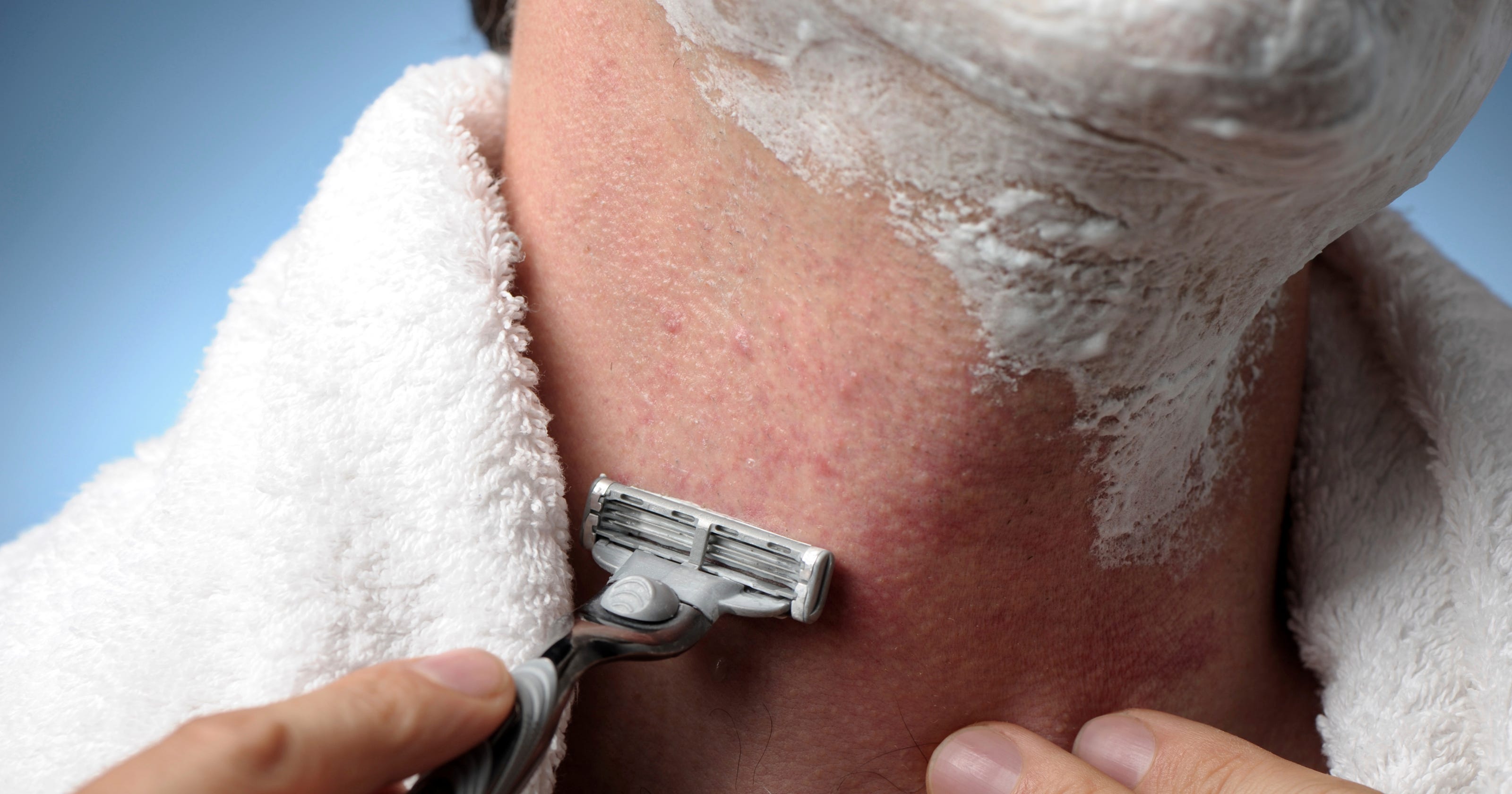 Tips For Dealing With Preventing Ingrown Hair