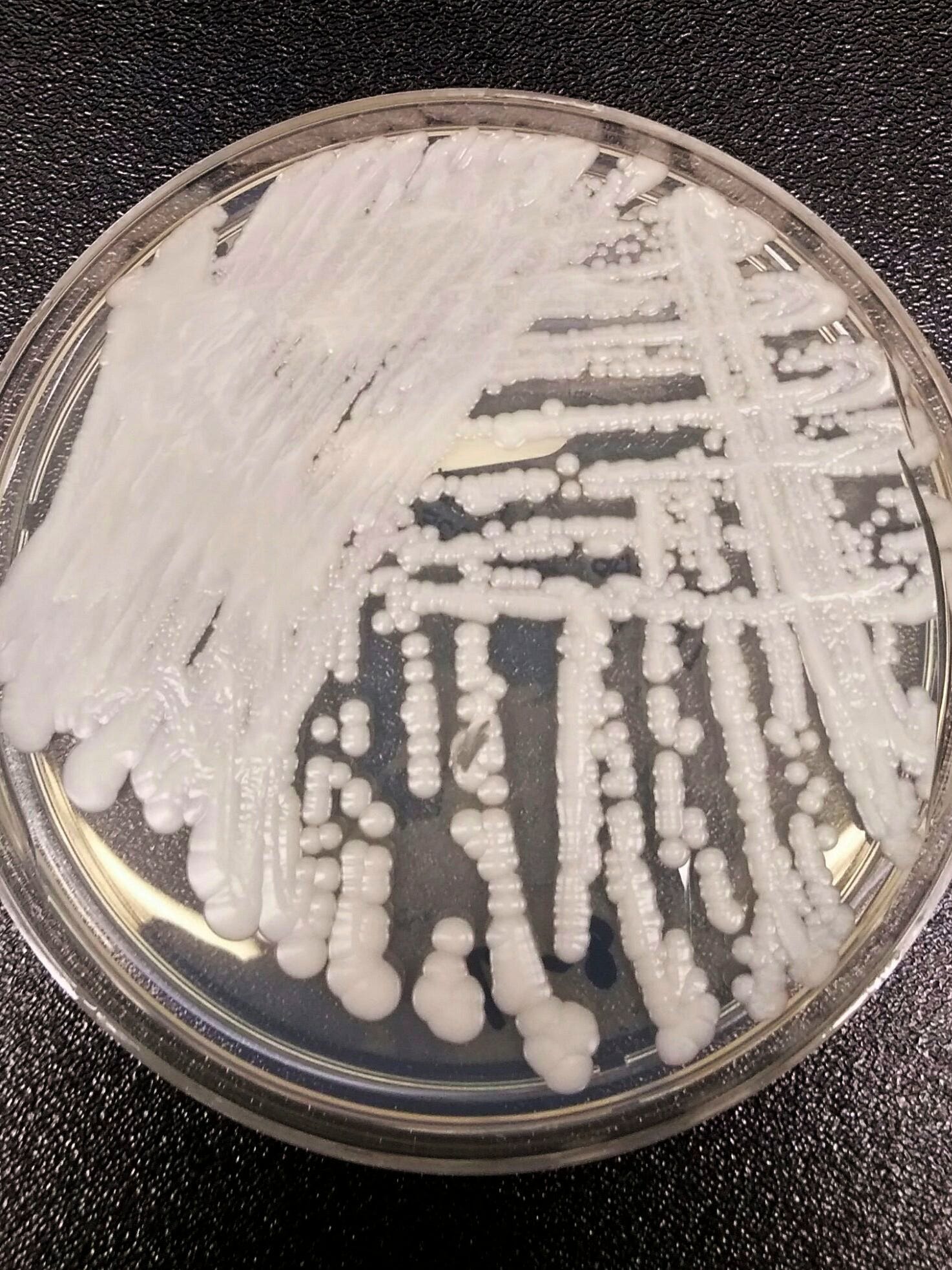 Fungus Candida Auris Superbug Is A Serious Global Health Threat Cdc