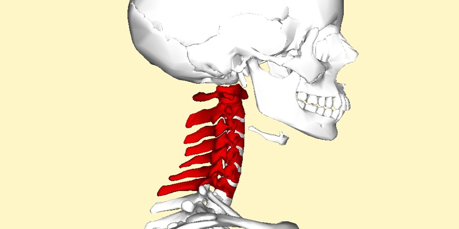 Pinched nerve pain can radiate to other areas
