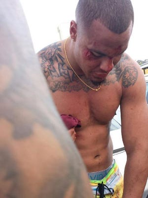 Panama City Beach police have reached out to Dak Prescott regarding incident that left cuts on his face during a spring break trip.