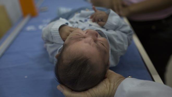 A doctor holds the head of one-month-old Alexandro Julio at the Oswaldo Cruz Hospital in Recife, Brazil, last Thursday, Julio was born with microcephaly, a brain defect in babies thought to be caused by the Zika virus.