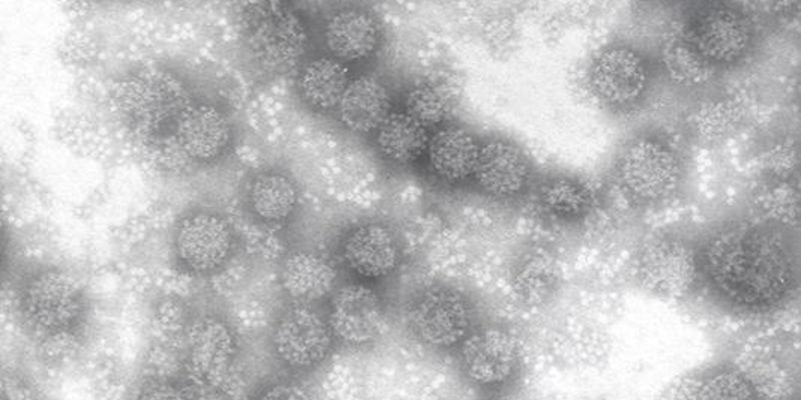 FDA to scrutinize HPV test linked to false readings