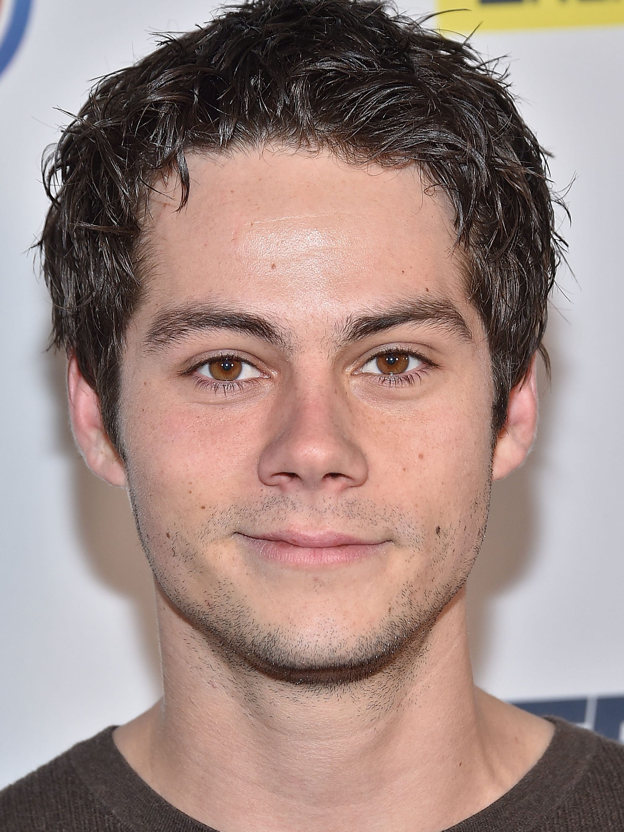 Dylan O Brien Injured On Maze Runner The Death Cure Set In one scene, he had to climb onto the roof of one car, being tied to another. dylan o brien injured on maze runner