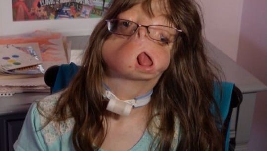 Girl Born Without A Face Finds Sister Across The World What i dislike is when the characters don't have their own personality, that one is lazy. girl born without a face finds sister