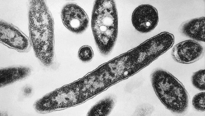 Legionella pneumophila bacteria under a microscope in 1978.