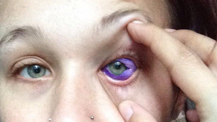 Sclera tattoo: Don't ink your eyeball. Just don't do it.