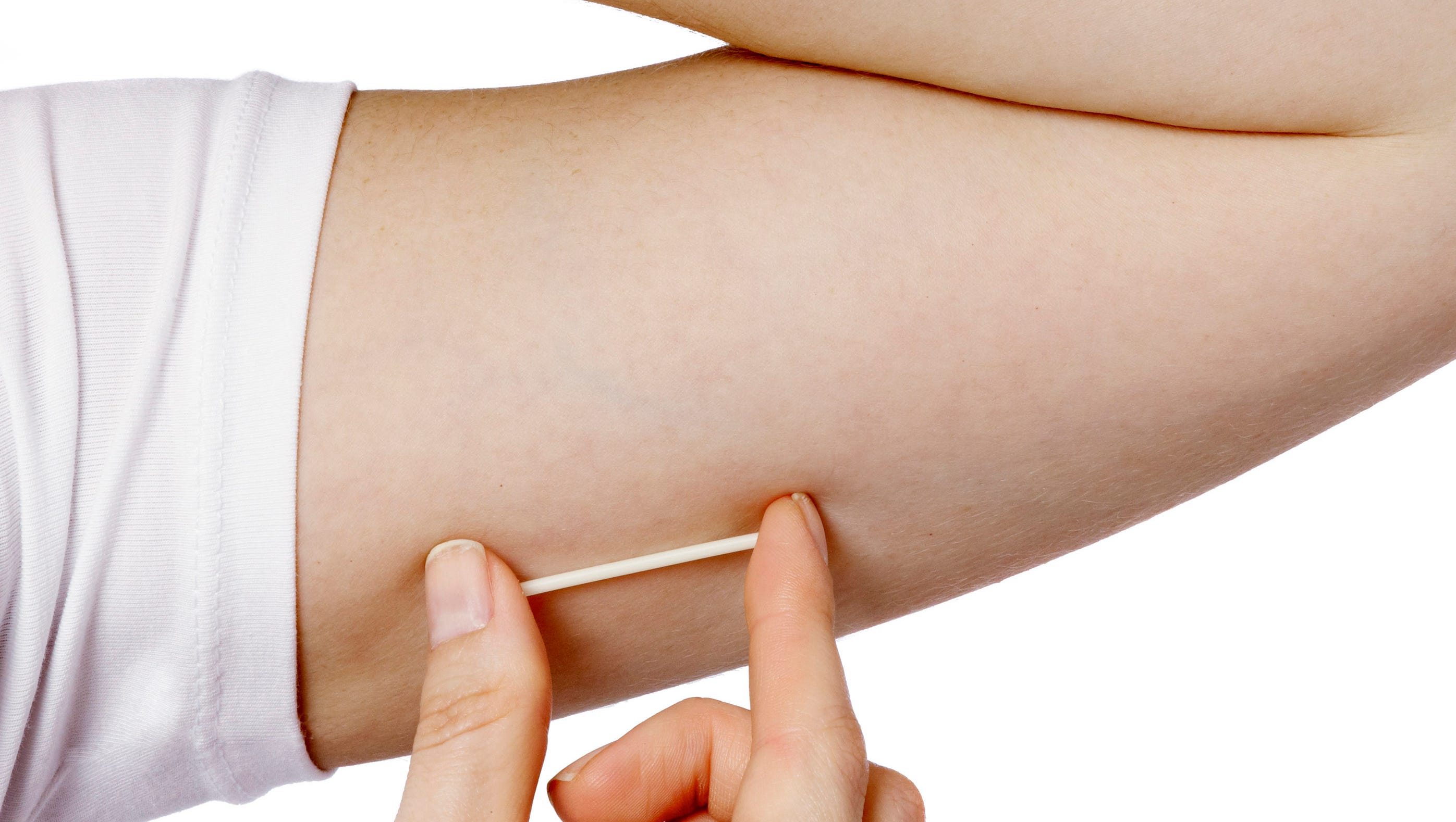Iud Implant - What Is Safer Iud Or Implant : Iuds and implants are very safe and effective for birth control.