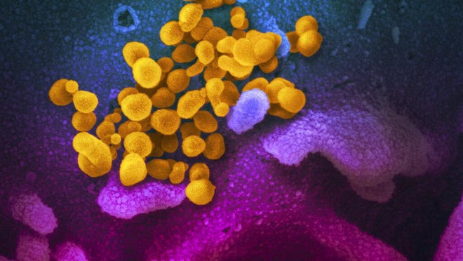 This scanning electron microscope image shows SARS-CoV-2 (yellow) — also known as 2019-nCoV, the virus that causes COVID-19 — isolated from a patient in the U.S., emerging from the surface of cells (blue/pink) cultured in the lab.