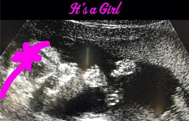 Kevin and Danielle Jonas share news of their baby's gender on Instagram.