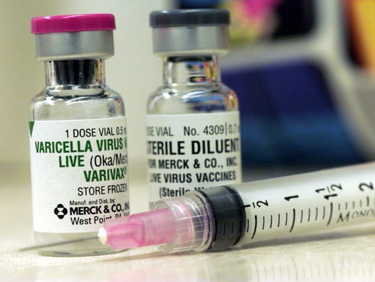 Chicken pox in Birmingham school district prompts email