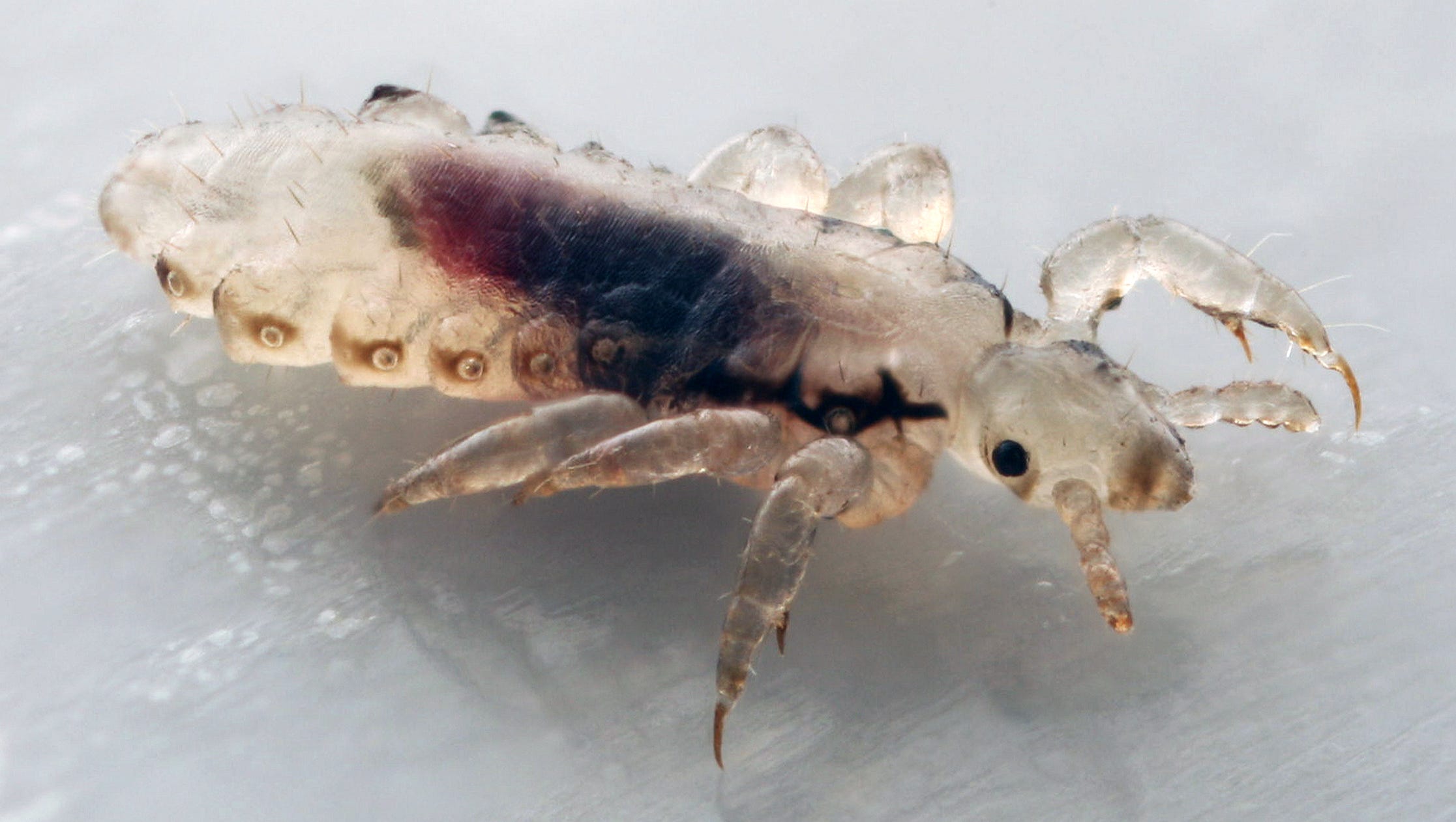 Super Lice Crawl Into 48 States You Can Stop Em Dead