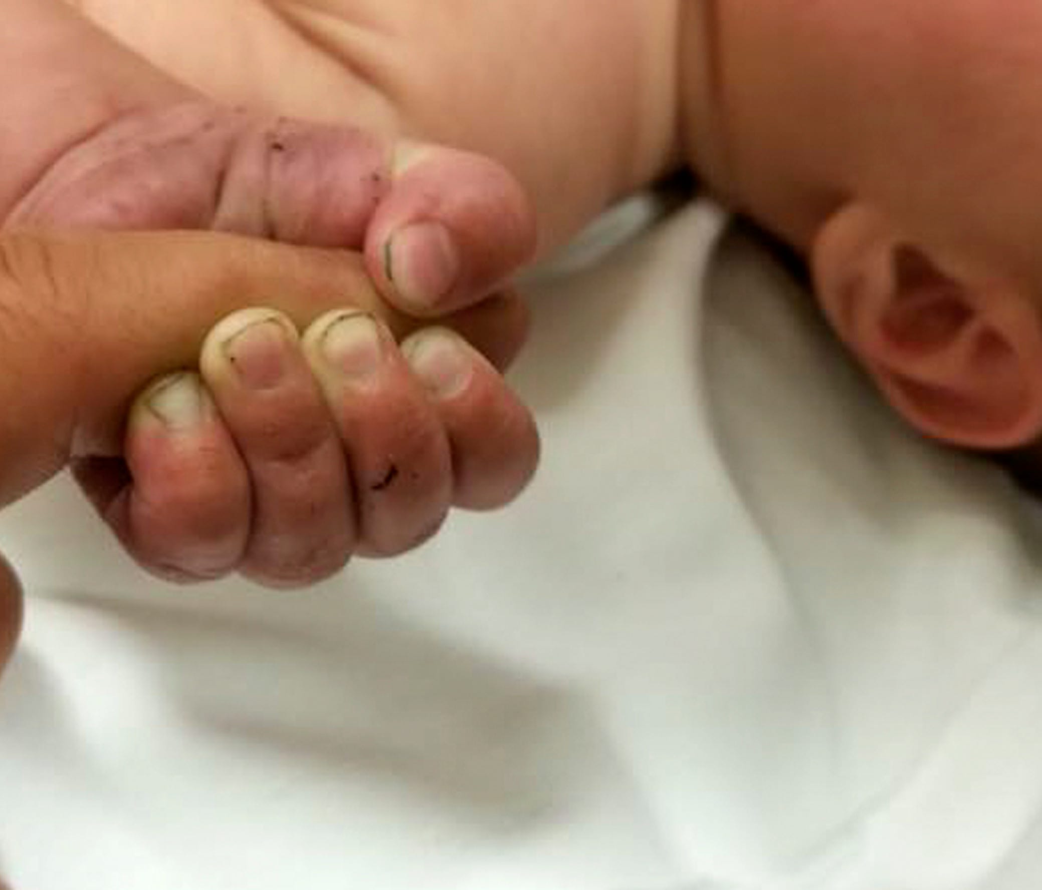 This July 8 photo provided by the Missoula County Sheriff's Office shows a 5-month-old infant with dirt under his fingernails after authorities say the baby survived about nine hours being buried under sticks and debris in the woods.