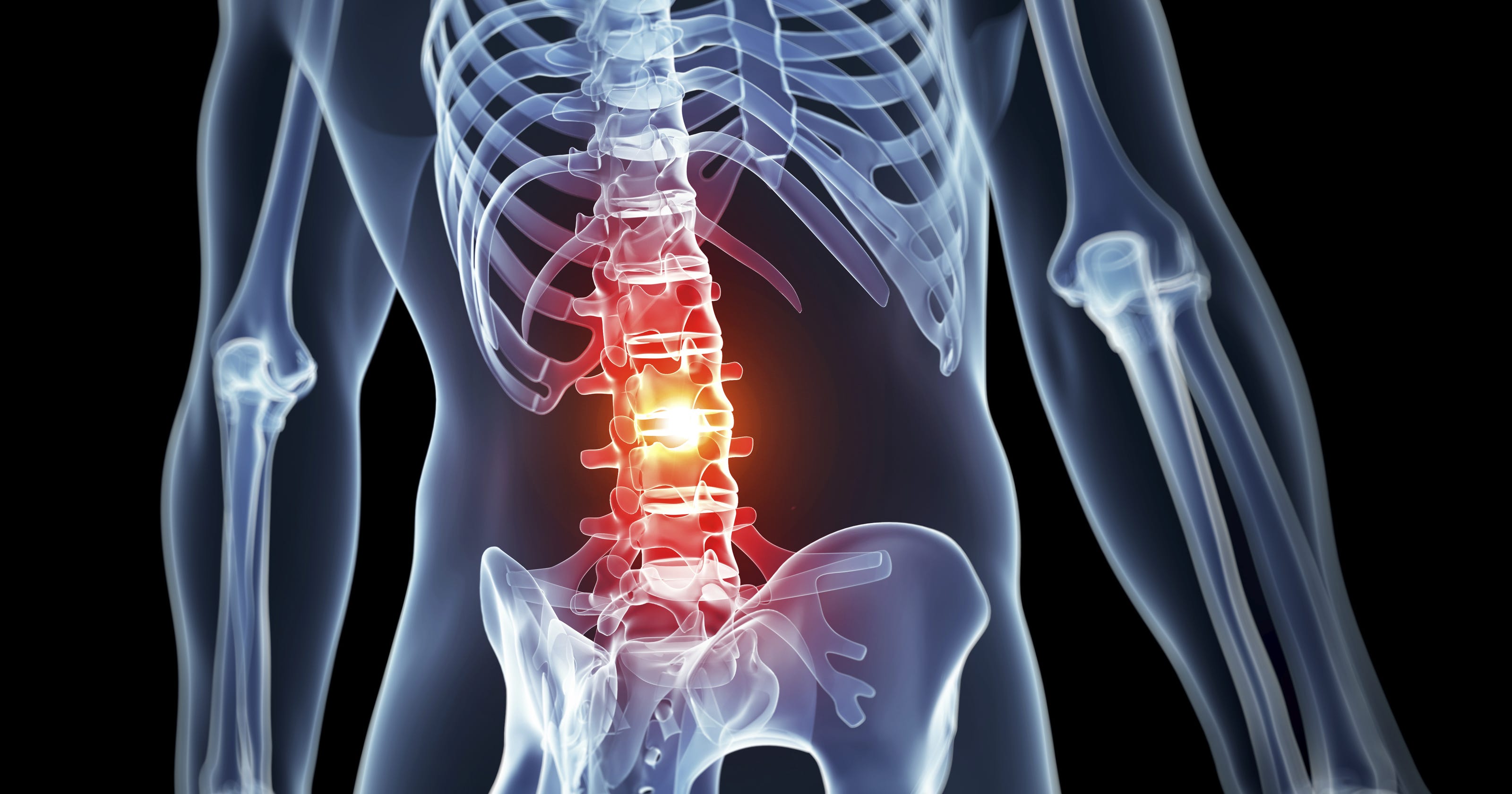 What is surgery on your lower back called?