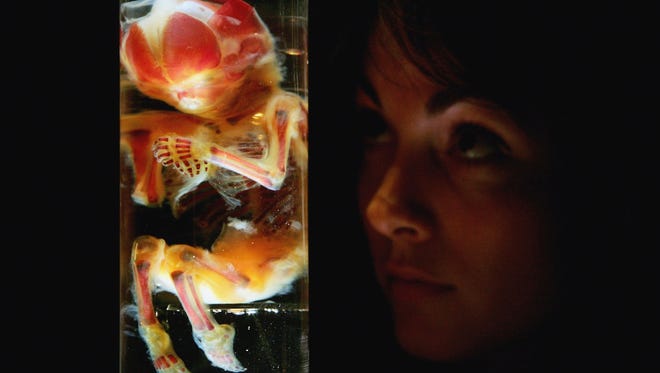 A woman examines an exhibit of a 20-week-old fetal bone development during the "Bodies.....The Exhibition" in London.