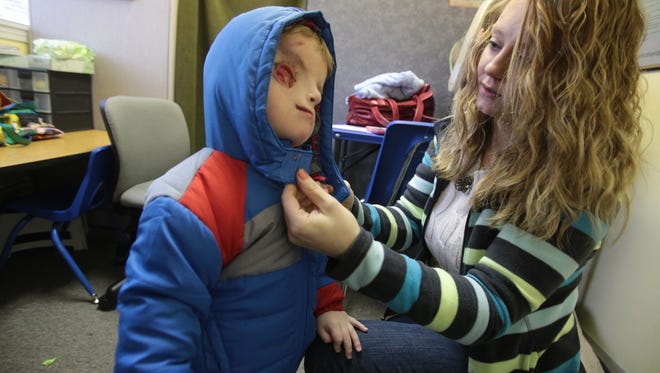 Lacey Buchanan closes the coat of her son, Christian, who is a patient at Special Kids Therapy and Nursing Center.