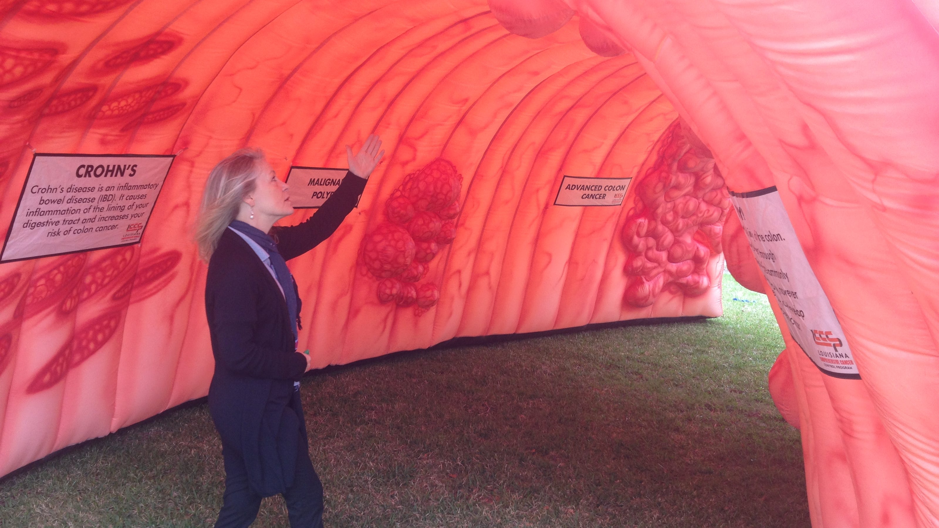 UHC to host giant inflatable colon exhibit