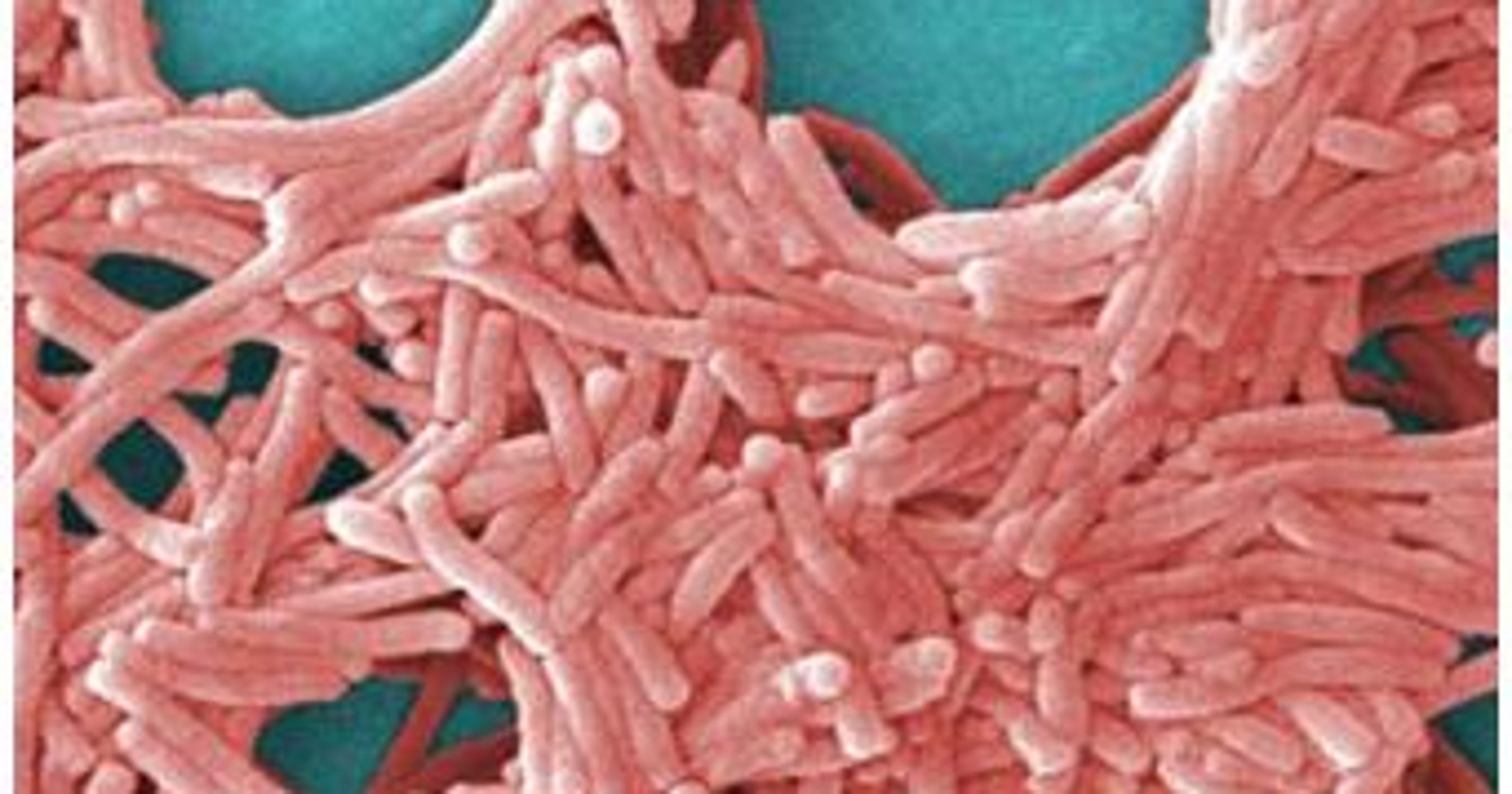 Legionnaires' disease: 6 things to know about outbreak in Ohio