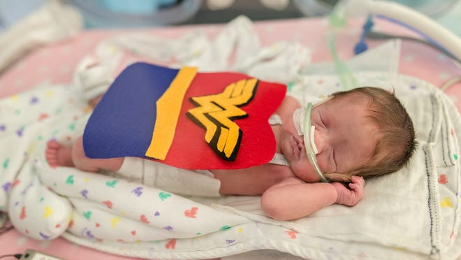 Le Plus Petit Bebe Du Monde Est Sorti Apres Avoir Passe Un An A L Hopital Les Actualites Le Plus Petit Bebe Du Monde Est Sorti Apres Avoir Passe Un An A L Hopital Les Actualites