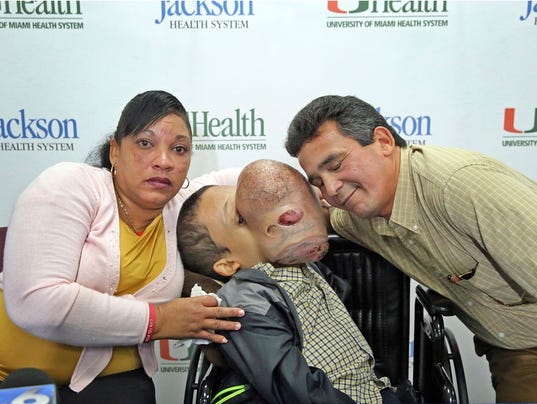 AP FACE TUMOR REMOVAL A USA FL