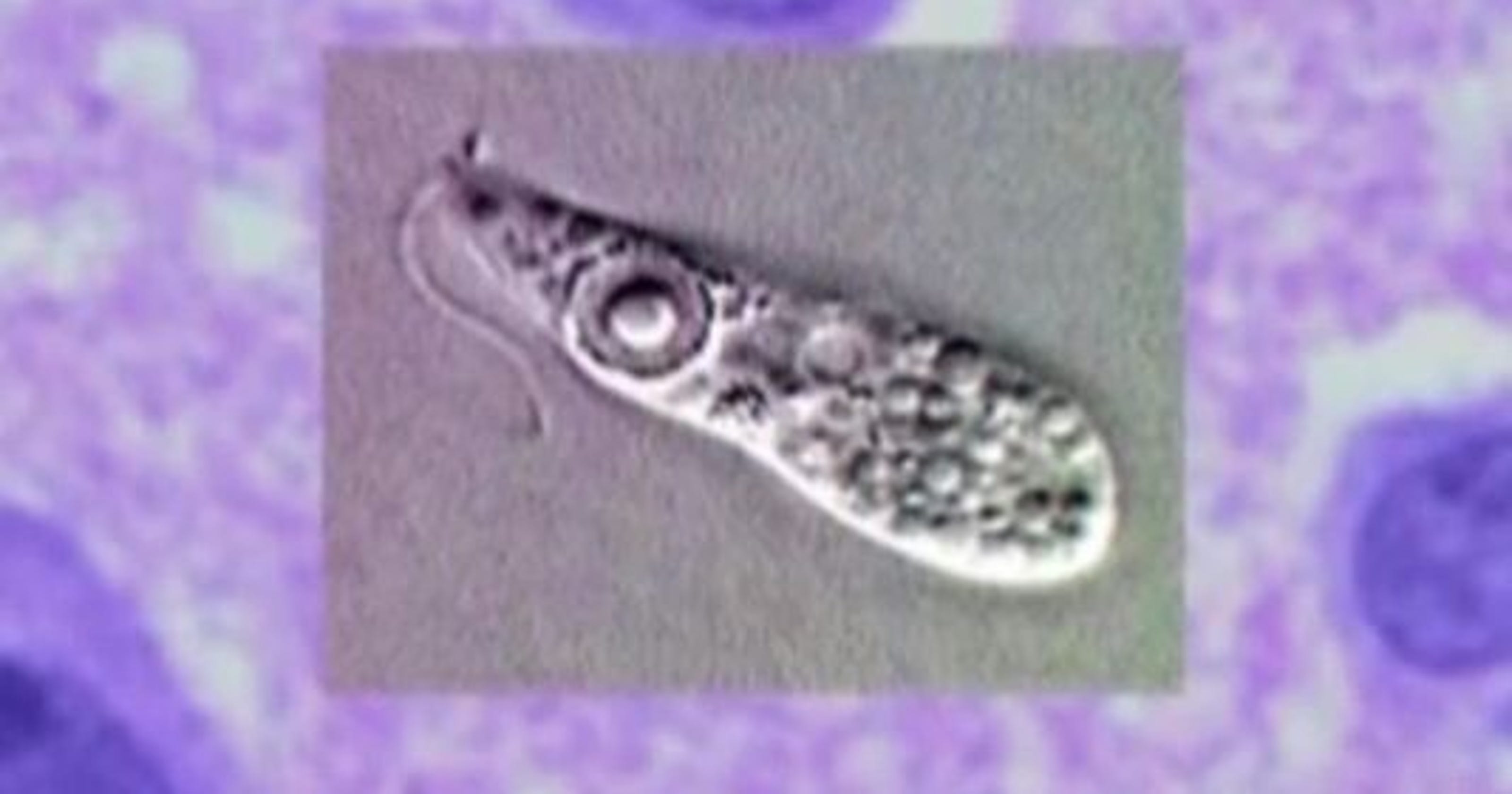 Braineating amoeba found in Louisiana water