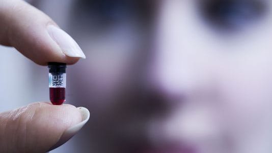 Theranos CEO Elizabeth Holmes holds one of the company's unique nanotainers, which holds mere drops of blood that can be tested through Theranos' proprietary bloodwork technology.