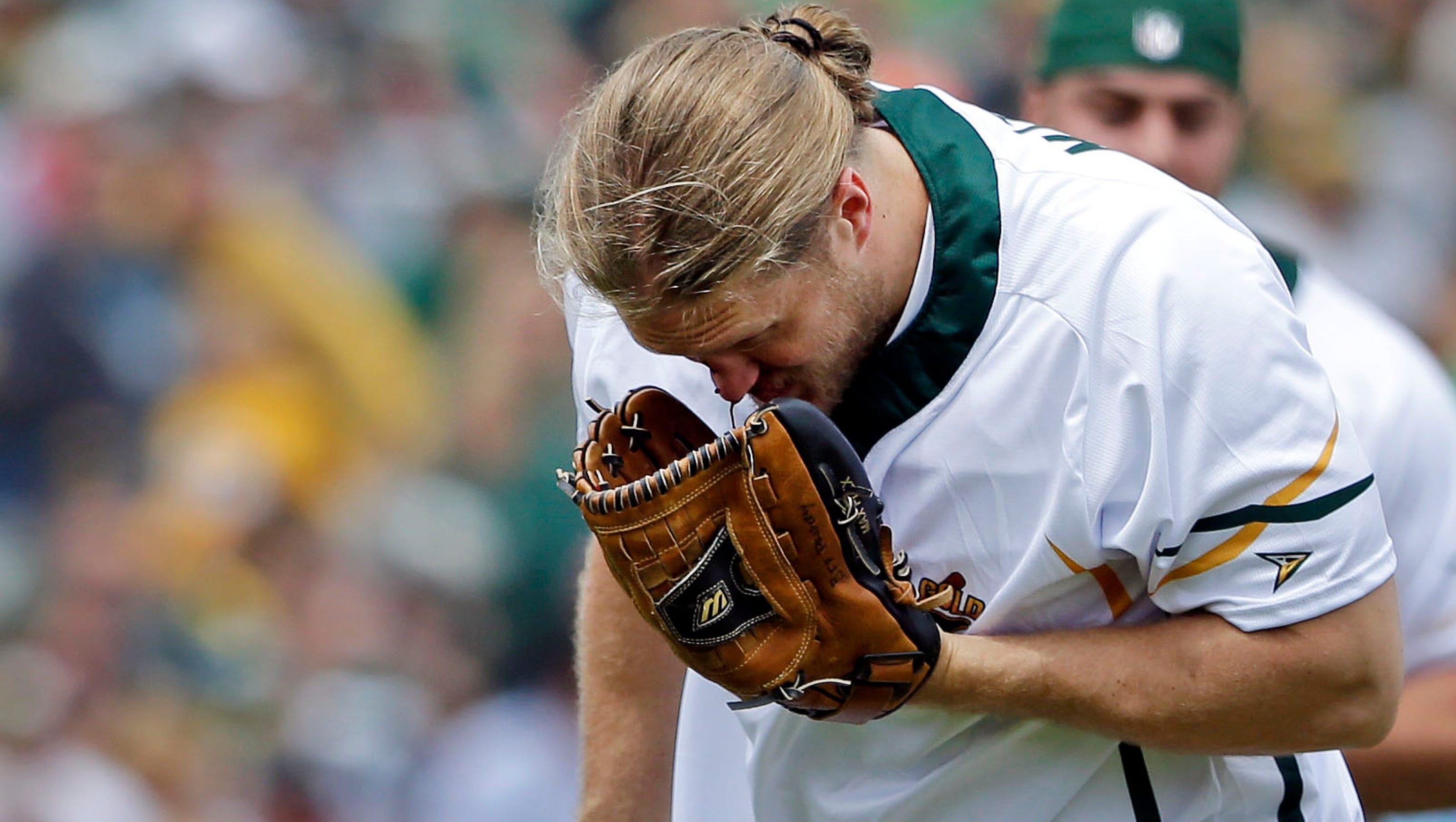 Packers' Clay Matthews suffers broken nose during softball game