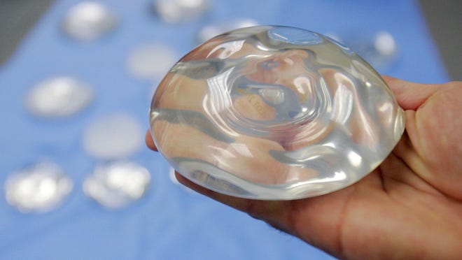 Most women choose silicone gel-filled implants after surgery.
