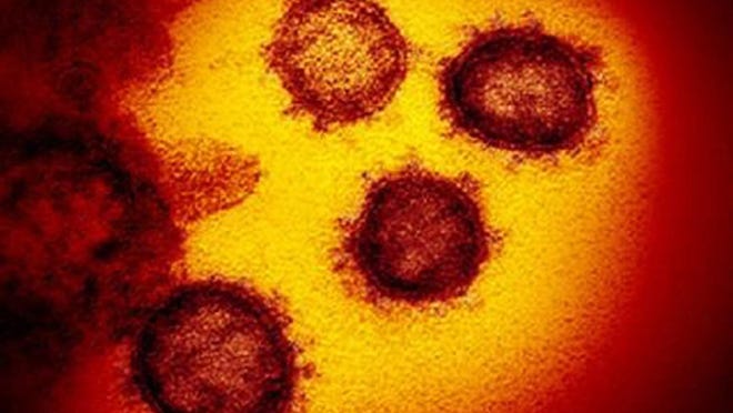 This transmission electron microscope image shows SARS-CoV-2, the virus that causes COVID-19, isolated from a patient in the U.S., emerging from the surface of cells cultured in the lab.