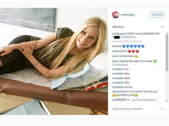 Avril Lavigne On Her Lyme Disease I M Coming Out On The