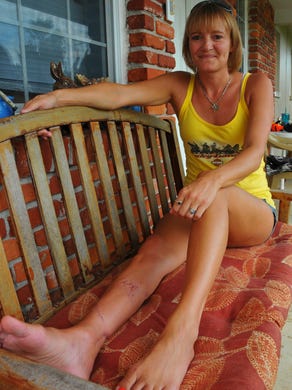 Amy Tatsch of Indian Harbour Bch was Boogie boarding with her brother at Ponce De Leon Landing Park in Melbourne Beach May 15 in cloudy water when she was bitten by a 6-7 foot Bull shark. Thirteen days in Holmes Regional medical Center and five surgeries later, she is doing well and continuing physical therapy. 58 exterior stiches on her lower right leg.
