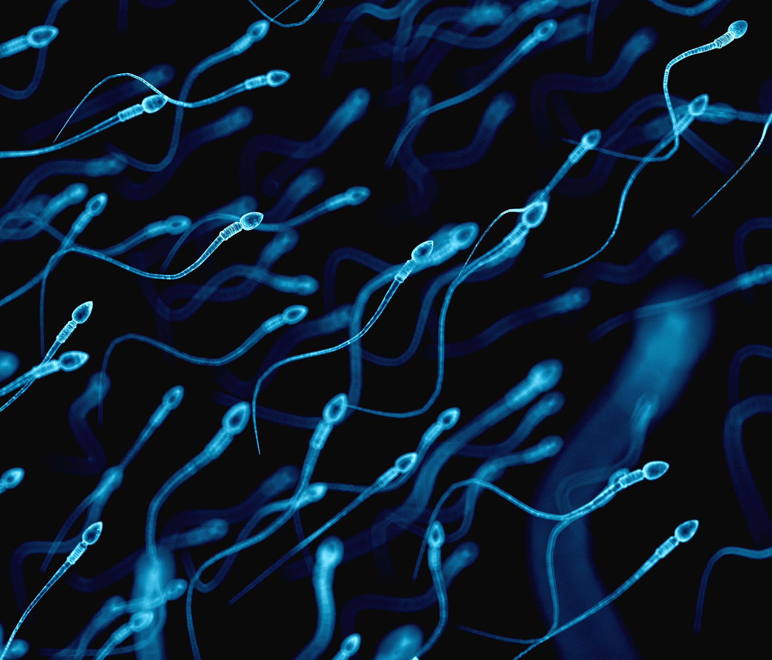 Cutting and cauterizing a man's vas deferens keeps these little swimmers, better known as sperm, from leaving the testes.