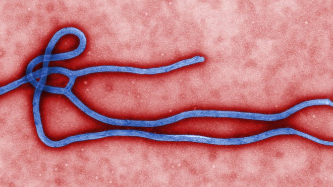 
This undated file image made available by the Centers for Disease Control shows the Ebola virus. 
