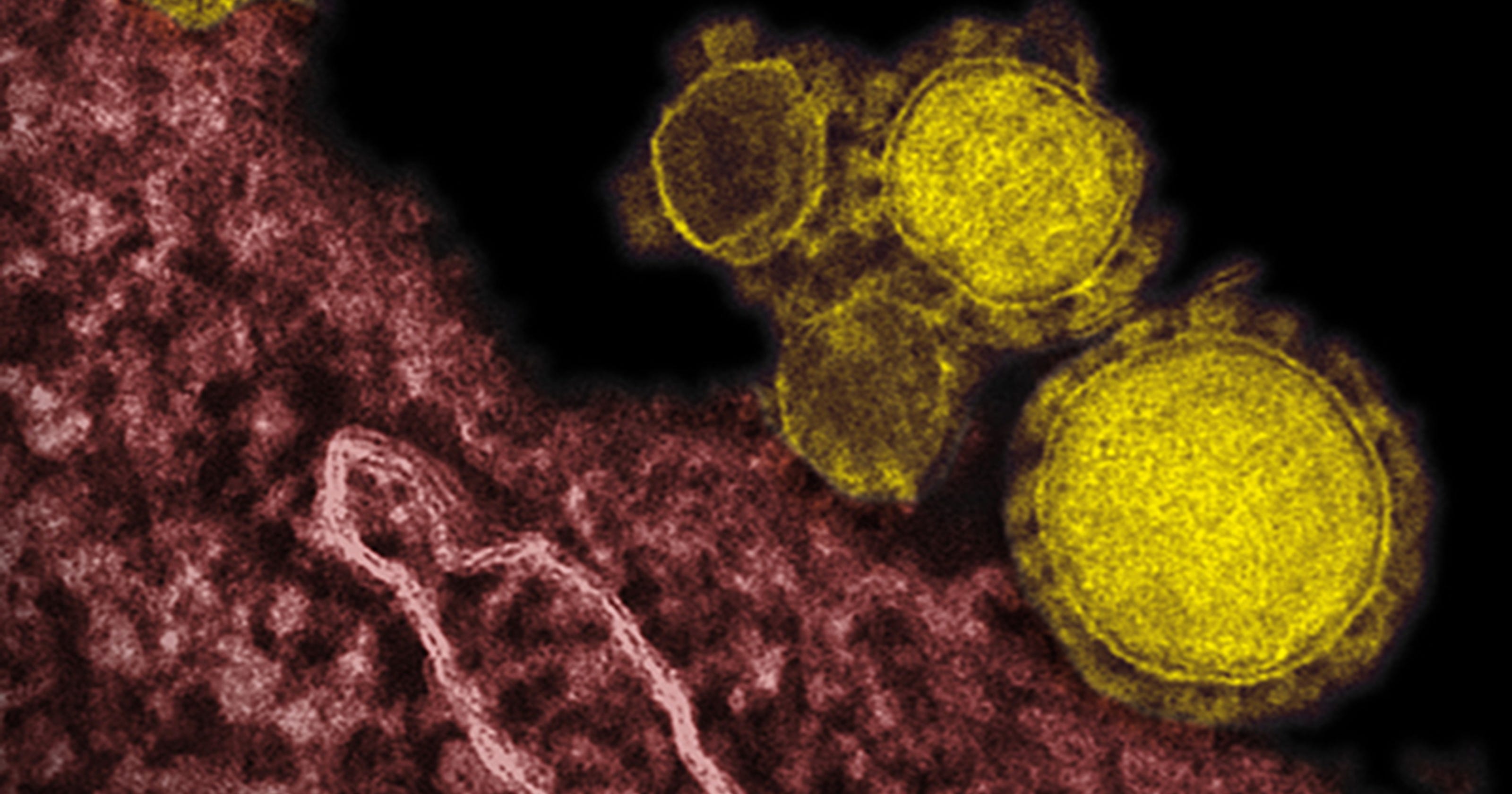 third u.s. mers case brings more questions than answers