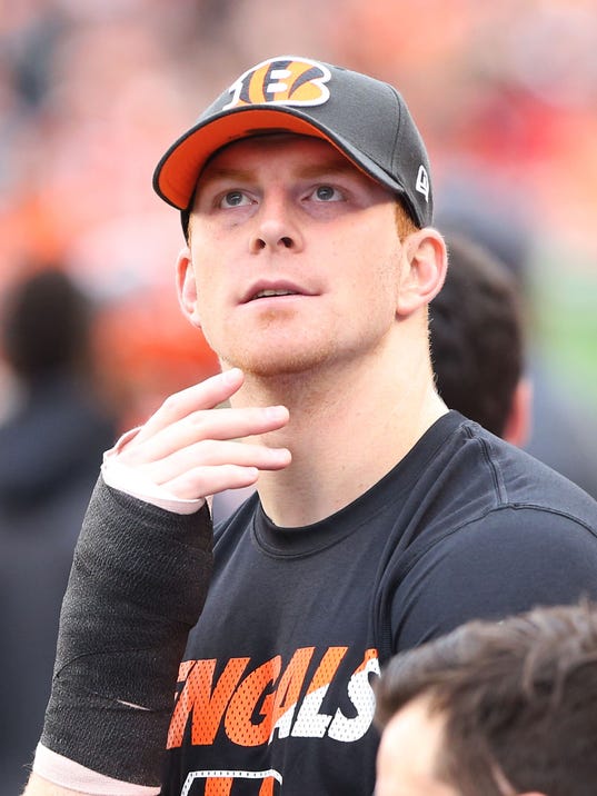 Expert: Andy Dalton's thumb likely a 4-week recovery in best-case scenario