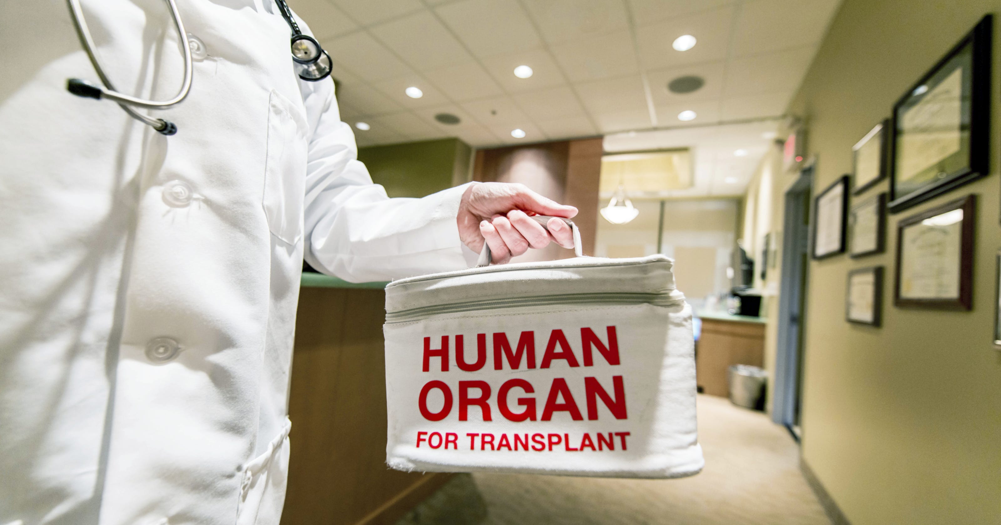 5 benefits of organ donations
