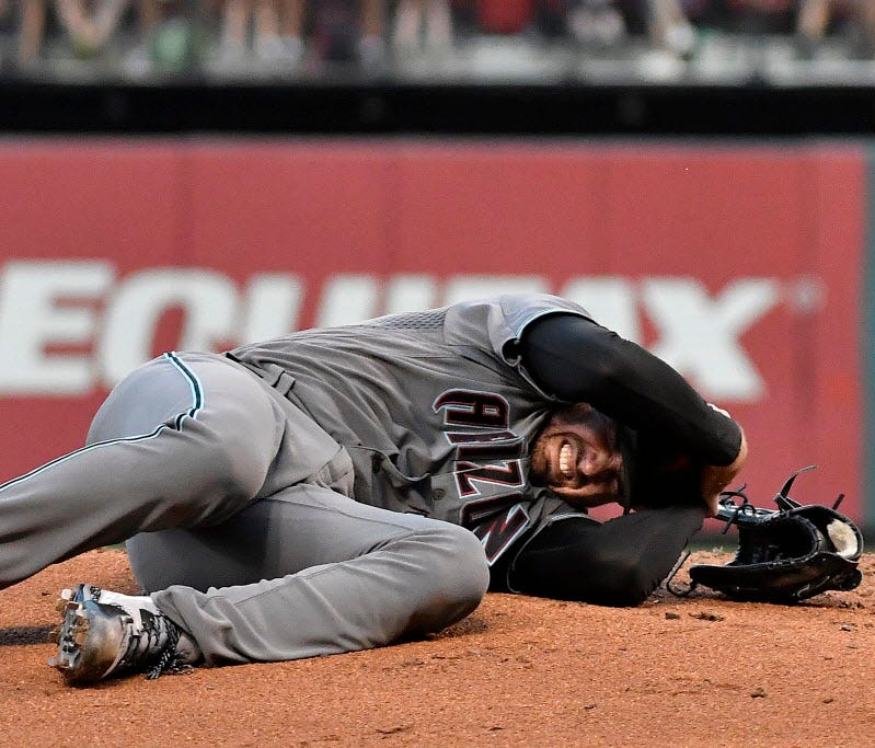 Diamondbacks starting pitcher Robbie Ray holds his head after he was hit by a line drive against the Cardinals during the second inning at Busch Stadium in St. Louis.