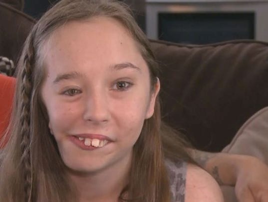 Teen With Facial Deformity Finds Reason To Smile 