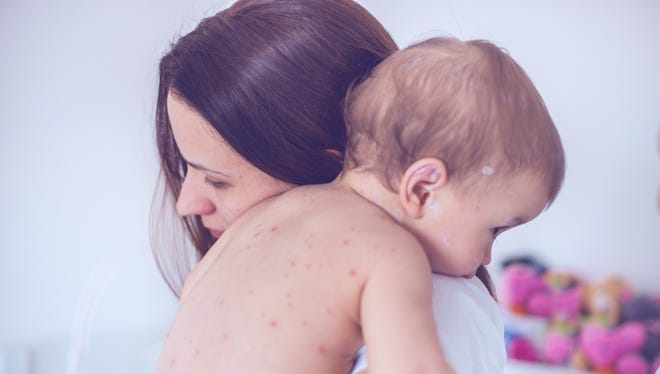 Babies' sensitive skin can be prone to rashes.