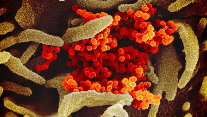 This scanning electron microscope image shows SARS-CoV-2 (orange)--also known as 2019-nCoV, the virus that causes COVID-19--isolated from a patient in the U.S., emerging from the surface of cells (green) cultured in the lab. Credit: NIAID-RML