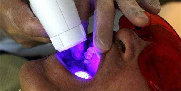 The Velscope offers high-intensity blue light and a magnifier, which improve the chances of detecting an oral cancer early.