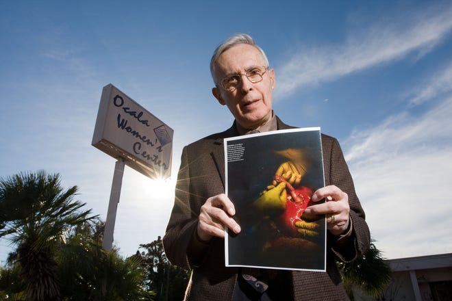 William Brennan, professor and anti-abortion activist, will be the keynote speaker at today's Rally for Life. He is seen Friday in front of the Ocala Women's Center, where abortions are performed, showing an image of a surgeon holding the hand of a 24-week-old fetus during an in-utero procedure to treat spina bifida.