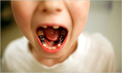 Ryan Massey, 7, shows his caps. Dentists near Charleston, W.Va., say pollutants in drinking water have damaged residents’ teeth. Nationwide, polluters have violated the Clean Water Act more than 500,000 times.