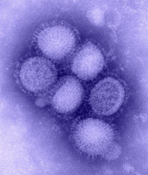 A microscopic image of the newly identified H1N1 influenza virus.