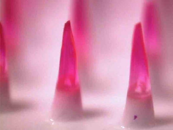 A microscopic image shows dissolving needles encapsulating a pink dye to simulate how a vaccine would be incorporated into the needles. Influenza vaccination can be achieved using microneedle-covered patches applied to the skin as reported in the Sunday edition of Nature Medicine. The study, conducted on mice, found that the microneedle patches were more efficient at clearing the lungs of virus and improved the immune system's antibody memory.