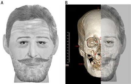 In this combination digital image made available by Jean-Noel Vignal and Isabelle Huynh-Charlier Wednesday Dec. 15, 2010, a reconstruction of the face France's King Henri IV is seen, left, and his skull with the reconstruction overlaid is seen at right.