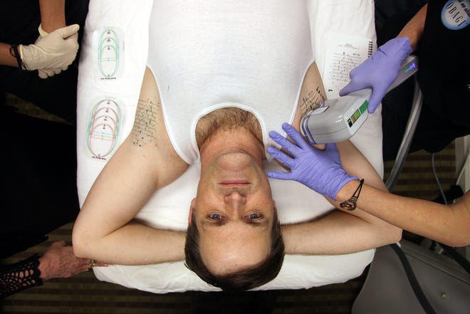 Dr. Jon Ward has his armpits pulsed with electro-magnetic waves during a new procedure to help with excessive sweating. 

Read more: http://www.newsherald.com/articles/solution-105540-excess-panama.html#ixzz26gH8DQR2