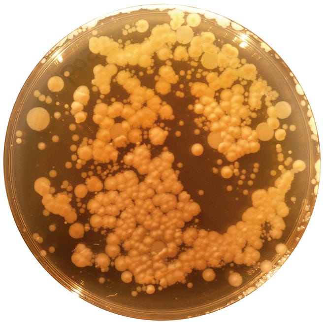 Staphylococcus epidermidis prevents attacks by pathogens.