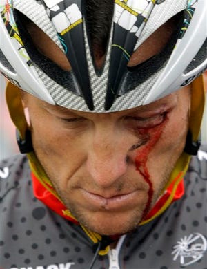 ADVANCE FOR WEEKEND EDITIONS, JUNE 22-23 - FILE - In this May 20, 2010 file photo, Lance Armstrong bleeds from a cut under his left eye after crashing during the fifth stage of the Tour of California cycling race in the outskirts of Visalia, Calif. The Tour de France, which starts next Saturday, June 29, 2013, remains a fantastic idea, not old even as it is put into practice for the 100th time. Asking riders to pedal around Western Europe's largest country and up and down some of its tallest mountains for three weeks is zany and whimsical enough to always be interesting. But is the Tour still worth taking seriously as a sports event? (AP Photo/Marcio Jose Sanchez, File)